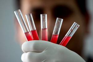 FDA Warning To Using Young Blood Try To Halt Aging Not Good Idea